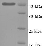 SDS-PAGE separation of QP8711 followed by commassie total protein stain results in a primary band consistent with reported data for SerpinE1 / PAI-1. These data demonstrate Greater than 90% as determined by SDS-PAGE.