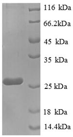 SDS-PAGE separation of QP8713 followed by commassie total protein stain results in a primary band consistent with reported data for Placental Lactogen / CSH1. These data demonstrate Greater than 90% as determined by SDS-PAGE.