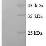 SDS-PAGE separation of QP8714 followed by commassie total protein stain results in a primary band consistent with reported data for Estrogen Receptor 1. These data demonstrate Greater than 90% as determined by SDS-PAGE.