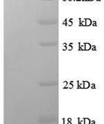 SDS-PAGE separation of QP8714 followed by commassie total protein stain results in a primary band consistent with reported data for Estrogen Receptor 1. These data demonstrate Greater than 90% as determined by SDS-PAGE.