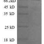 SDS-PAGE separation of QP8719 followed by commassie total protein stain results in a primary band consistent with reported data for Paired box protein Pax-2. These data demonstrate Greater than 90% as determined by SDS-PAGE.