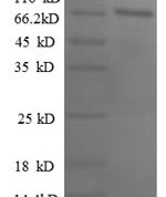SDS-PAGE separation of QP8719 followed by commassie total protein stain results in a primary band consistent with reported data for Paired box protein Pax-2. These data demonstrate Greater than 90% as determined by SDS-PAGE.