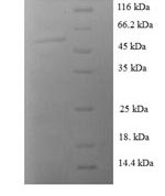 SDS-PAGE separation of QP872 followed by commassie total protein stain results in a primary band consistent with reported data for 14-3-3 sigma / Stratifin / YWHAS. These data demonstrate Greater than 90% as determined by SDS-PAGE.