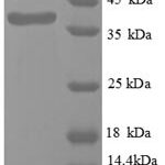 SDS-PAGE separation of QP8720 followed by commassie total protein stain results in a primary band consistent with reported data for Wilm's Tumor 1. These data demonstrate Greater than 90% as determined by SDS-PAGE.