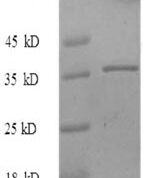SDS-PAGE separation of QP8721 followed by commassie total protein stain results in a primary band consistent with reported data for MKI67. These data demonstrate Greater than 90% as determined by SDS-PAGE.