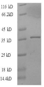 SDS-PAGE separation of QP8721 followed by commassie total protein stain results in a primary band consistent with reported data for MKI67. These data demonstrate Greater than 90% as determined by SDS-PAGE.