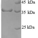 SDS-PAGE separation of QP8723 followed by commassie total protein stain results in a primary band consistent with reported data for Cyclin-dependent kinase 4. These data demonstrate Greater than 90% as determined by SDS-PAGE.