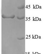 SDS-PAGE separation of QP8723 followed by commassie total protein stain results in a primary band consistent with reported data for Cyclin-dependent kinase 4. These data demonstrate Greater than 90% as determined by SDS-PAGE.