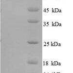 SDS-PAGE separation of QP8724 followed by commassie total protein stain results in a primary band consistent with reported data for P63 / TP63. These data demonstrate Greater than 90% as determined by SDS-PAGE.