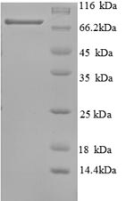 SDS-PAGE separation of QP8724 followed by commassie total protein stain results in a primary band consistent with reported data for P63 / TP63. These data demonstrate Greater than 90% as determined by SDS-PAGE.