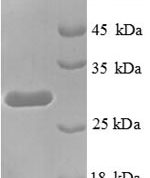 SDS-PAGE separation of QP8725 followed by commassie total protein stain results in a primary band consistent with reported data for Transcription termination factor 1. These data demonstrate Greater than 90% as determined by SDS-PAGE.