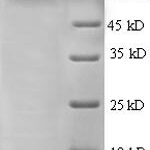 SDS-PAGE separation of QP8726 followed by commassie total protein stain results in a primary band consistent with reported data for Glutamate carboxypeptidase 2. These data demonstrate Greater than 90% as determined by SDS-PAGE.