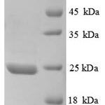 SDS-PAGE separation of QP8728 followed by commassie total protein stain results in a primary band consistent with reported data for TIMP-3. These data demonstrate Greater than 80% as determined by SDS-PAGE.