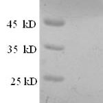 SDS-PAGE separation of QP8733 followed by commassie total protein stain results in a primary band consistent with reported data for Prostate stem cell antigen. These data demonstrate Greater than 90% as determined by SDS-PAGE.