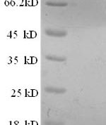 SDS-PAGE separation of QP8733 followed by commassie total protein stain results in a primary band consistent with reported data for Prostate stem cell antigen. These data demonstrate Greater than 90% as determined by SDS-PAGE.