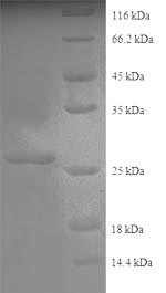 SDS-PAGE separation of QP8734 followed by commassie total protein stain results in a primary band consistent with reported data for Collagen alpha-2(IV) chain. These data demonstrate Greater than 90% as determined by SDS-PAGE.