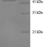 SDS-PAGE separation of QP8735 followed by commassie total protein stain results in a primary band consistent with reported data for TNFAIP8. These data demonstrate Greater than 90% as determined by SDS-PAGE.