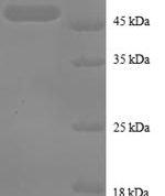 SDS-PAGE separation of QP8735 followed by commassie total protein stain results in a primary band consistent with reported data for TNFAIP8. These data demonstrate Greater than 90% as determined by SDS-PAGE.