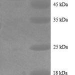 SDS-PAGE separation of QP8736 followed by commassie total protein stain results in a primary band consistent with reported data for Alkaline Phosphatase. These data demonstrate Greater than 80% as determined by SDS-PAGE.