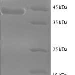 SDS-PAGE separation of QP8737 followed by commassie total protein stain results in a primary band consistent with reported data for Sperm surface protein Sp17. These data demonstrate Greater than 90% as determined by SDS-PAGE.