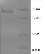 SDS-PAGE separation of QP8737 followed by commassie total protein stain results in a primary band consistent with reported data for Sperm surface protein Sp17. These data demonstrate Greater than 90% as determined by SDS-PAGE.