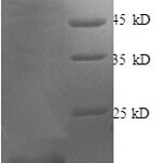 SDS-PAGE separation of QP8747 followed by commassie total protein stain results in a primary band consistent with reported data for bFGF / FGF2. These data demonstrate Greater than 90% as determined by SDS-PAGE.