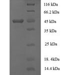 SDS-PAGE separation of QP8749 followed by commassie total protein stain results in a primary band consistent with reported data for Collagen alpha-1(XVIII) chain. These data demonstrate Greater than 90% as determined by SDS-PAGE.