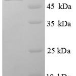 SDS-PAGE separation of QP8751 followed by commassie total protein stain results in a primary band consistent with reported data for B7-H4 / B7S1 / B7x. These data demonstrate Greater than 90% as determined by SDS-PAGE.