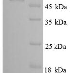 SDS-PAGE separation of QP8754 followed by commassie total protein stain results in a primary band consistent with reported data for CANT1. These data demonstrate Greater than 90% as determined by SDS-PAGE.