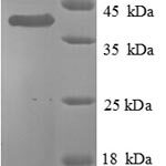 SDS-PAGE separation of QP8758 followed by commassie total protein stain results in a primary band consistent with reported data for Fatty acid synthase. These data demonstrate Greater than 90% as determined by SDS-PAGE.