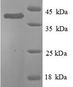 SDS-PAGE separation of QP8758 followed by commassie total protein stain results in a primary band consistent with reported data for Fatty acid synthase. These data demonstrate Greater than 90% as determined by SDS-PAGE.