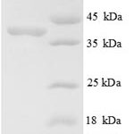 SDS-PAGE separation of QP8760 followed by commassie total protein stain results in a primary band consistent with reported data for E3 ubiquitin-protein ligase MIB1. These data demonstrate Greater than 90% as determined by SDS-PAGE.