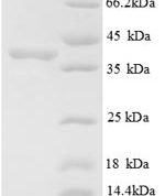 SDS-PAGE separation of QP8760 followed by commassie total protein stain results in a primary band consistent with reported data for E3 ubiquitin-protein ligase MIB1. These data demonstrate Greater than 90% as determined by SDS-PAGE.