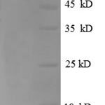 SDS-PAGE separation of QP8761 followed by commassie total protein stain results in a primary band consistent with reported data for SLC43A1. These data demonstrate Greater than 90% as determined by SDS-PAGE.