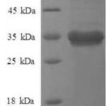 SDS-PAGE separation of QP8762 followed by commassie total protein stain results in a primary band consistent with reported data for Metalloreductase STEAP1. These data demonstrate Greater than 90% as determined by SDS-PAGE.