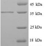 SDS-PAGE separation of QP8763 followed by commassie total protein stain results in a primary band consistent with reported data for Tropomyosin beta chain. These data demonstrate Greater than 86.7% as determined by SDS-PAGE.