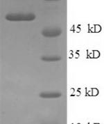 SDS-PAGE separation of QP8764 followed by commassie total protein stain results in a primary band consistent with reported data for Podocalyxin. These data demonstrate Greater than 90% as determined by SDS-PAGE.