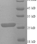 SDS-PAGE separation of QP8767 followed by commassie total protein stain results in a primary band consistent with reported data for Zinc finger matrin-type protein 2. These data demonstrate Greater than 90% as determined by SDS-PAGE.