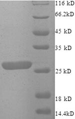 SDS-PAGE separation of QP8767 followed by commassie total protein stain results in a primary band consistent with reported data for Zinc finger matrin-type protein 2. These data demonstrate Greater than 90% as determined by SDS-PAGE.