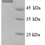 SDS-PAGE separation of QP8772 followed by commassie total protein stain results in a primary band consistent with reported data for 60 kDa SS-A / Ro ribonucleoprotein. These data demonstrate Greater than 90% as determined by SDS-PAGE.