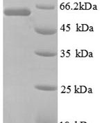 SDS-PAGE separation of QP8772 followed by commassie total protein stain results in a primary band consistent with reported data for 60 kDa SS-A / Ro ribonucleoprotein. These data demonstrate Greater than 90% as determined by SDS-PAGE.