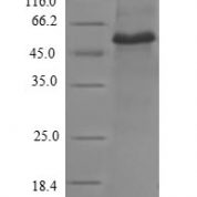 SDS-PAGE separation of QP8773 followed by commassie total protein stain results in a primary band consistent with reported data for VCL / Vinculin. These data demonstrate Greater than 90% as determined by SDS-PAGE.
