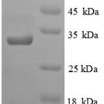 SDS-PAGE separation of QP8783 followed by commassie total protein stain results in a primary band consistent with reported data for Glutamate receptor ionotropic