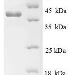 SDS-PAGE separation of QP8786 followed by commassie total protein stain results in a primary band consistent with reported data for AGER / RAGE. These data demonstrate Greater than 90% as determined by SDS-PAGE.