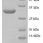 SDS-PAGE separation of QP8789 followed by commassie total protein stain results in a primary band consistent with reported data for Laminin subunit beta-1. These data demonstrate Greater than 90% as determined by SDS-PAGE.