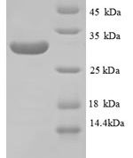 SDS-PAGE separation of QP8789 followed by commassie total protein stain results in a primary band consistent with reported data for Laminin subunit beta-1. These data demonstrate Greater than 90% as determined by SDS-PAGE.