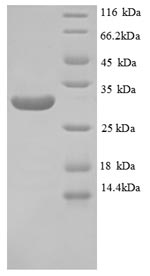 SDS-PAGE separation of QP8789 followed by commassie total protein stain results in a primary band consistent with reported data for Laminin subunit beta-1. These data demonstrate Greater than 90% as determined by SDS-PAGE.