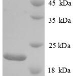 SDS-PAGE separation of QP8792 followed by commassie total protein stain results in a primary band consistent with reported data for Urokinase / PLAU. These data demonstrate Greater than 90% as determined by SDS-PAGE.