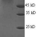 SDS-PAGE separation of QP8794 followed by commassie total protein stain results in a primary band consistent with reported data for Urease subunit beta. These data demonstrate Greater than 90% as determined by SDS-PAGE.