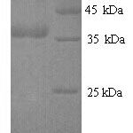 SDS-PAGE separation of QP8795 followed by commassie total protein stain results in a primary band consistent with reported data for cagA. These data demonstrate Greater than 90% as determined by SDS-PAGE.